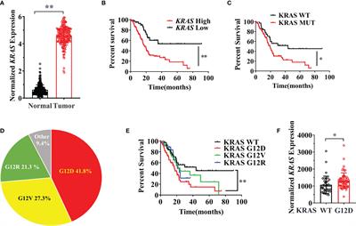 SEMA3C Supports Pancreatic Cancer Progression by Regulating the Autophagy Process and Tumor Immune Microenvironment